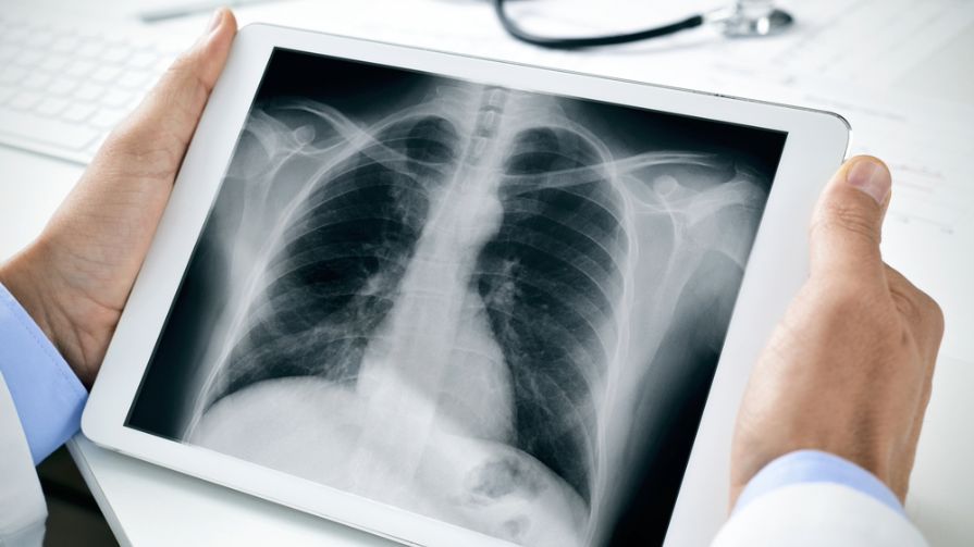 Medical professional examines chest X-ray on iPad.